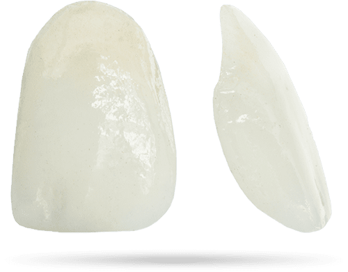 dental-veneers model