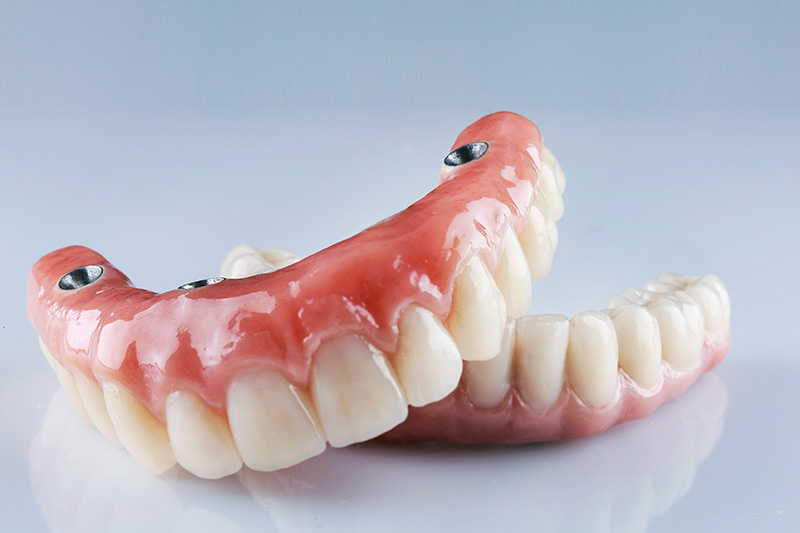 zirconia composition of dental prostheses