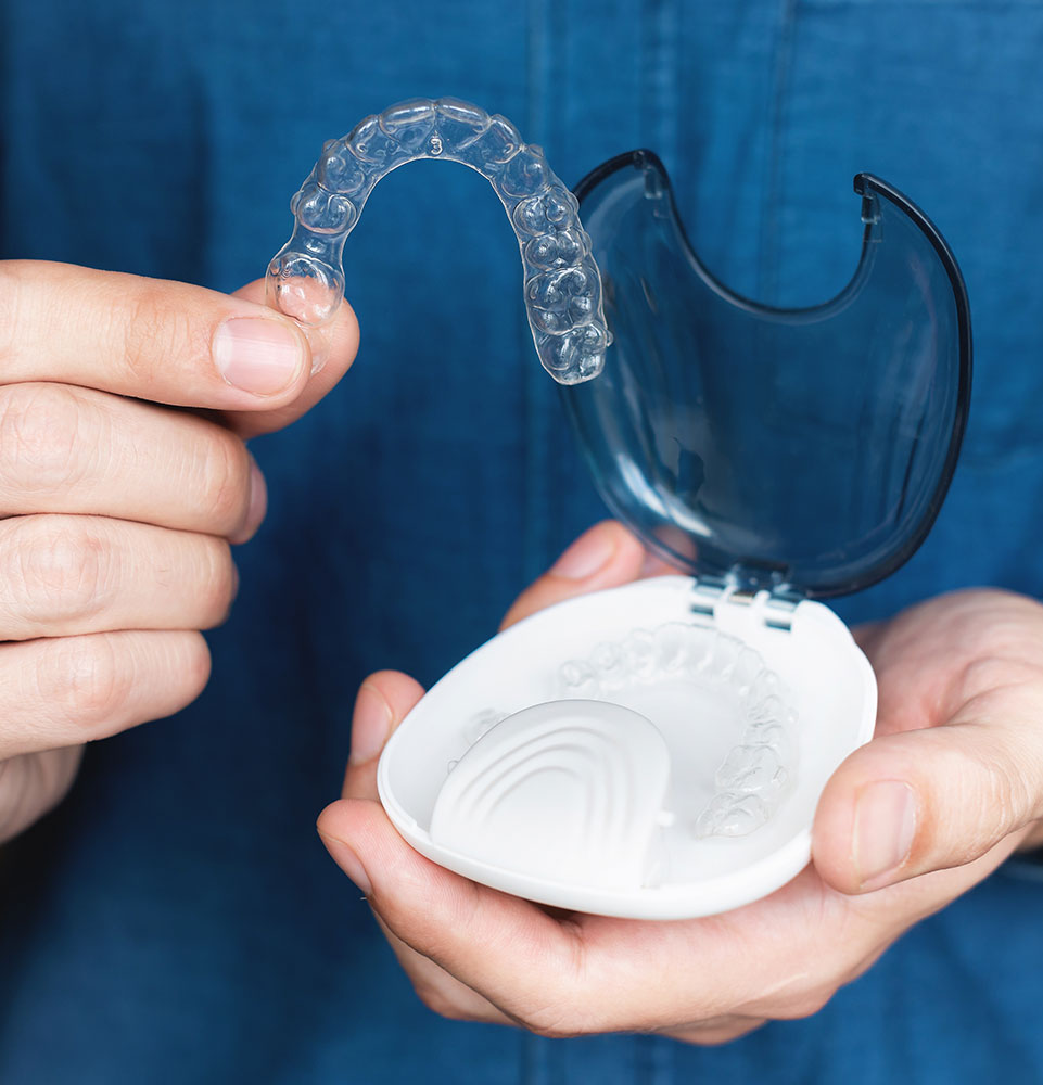 invisalign clear aligners