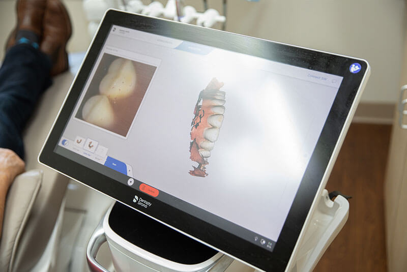 dental technology