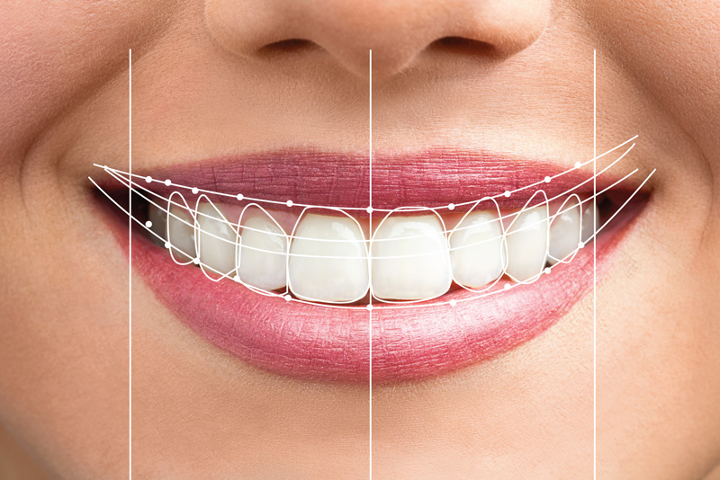 dental Smiledesign