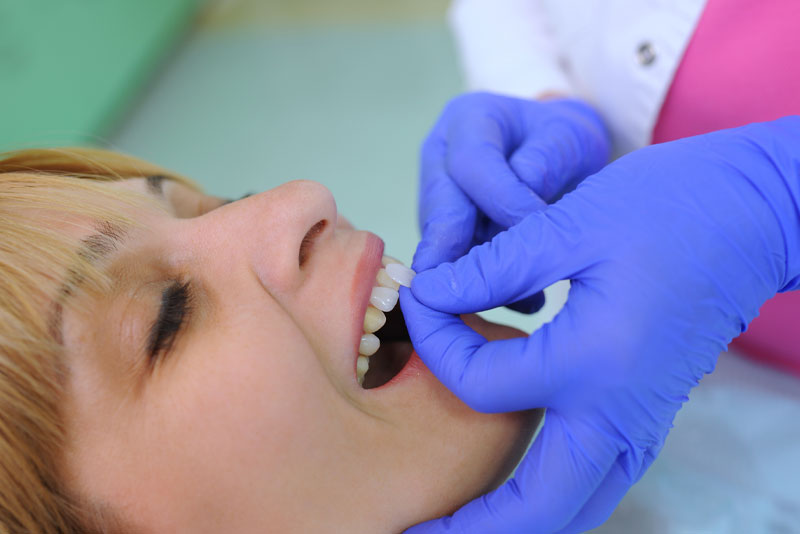 dental-patient-undergoing-porcelain-veneers-procedure
