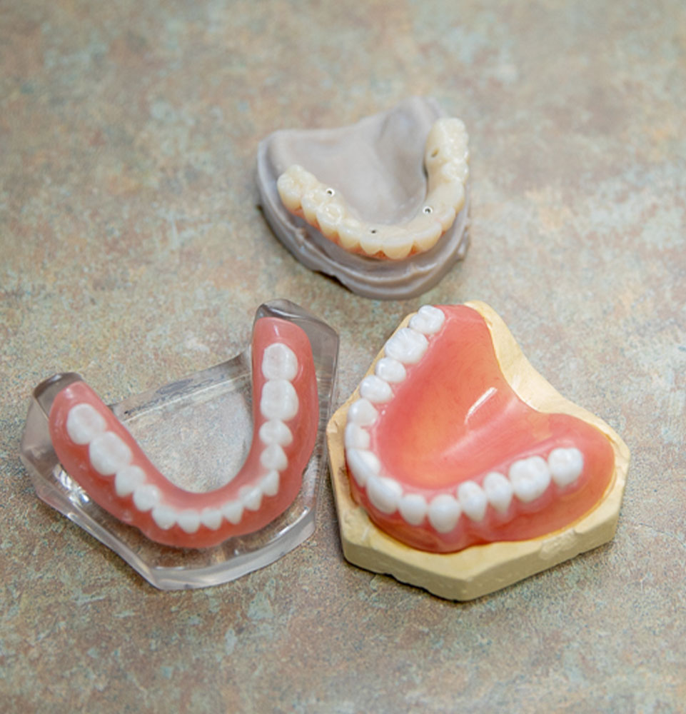 dentures and full arch dental implants